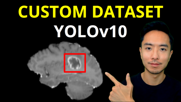 YOLOv10 Custom Dataset Training Object Detection Brain Tumors